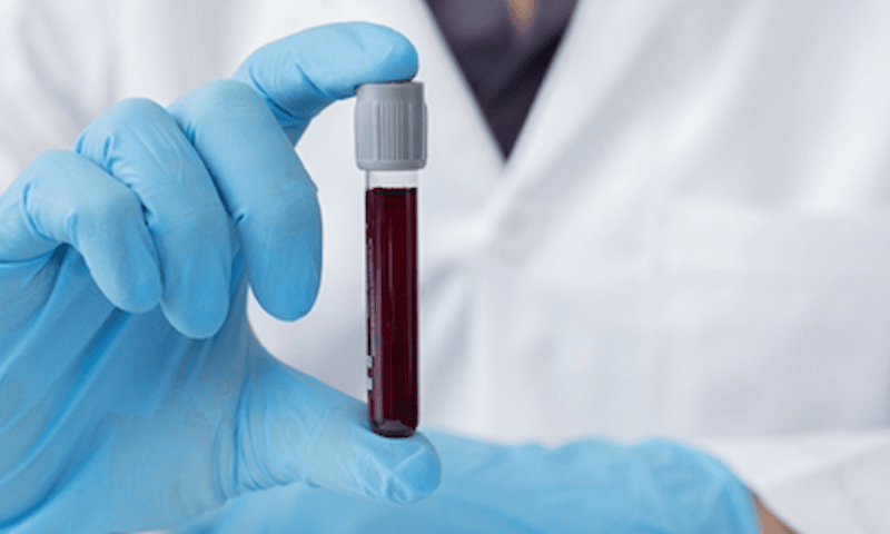 Bientôt, un simple test sanguin pourrait déterminer notre risque de démence